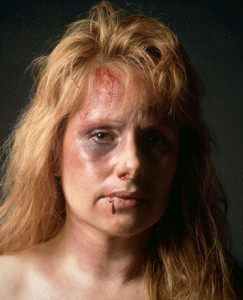 battered_woman_2_large-243x300